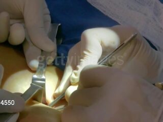 Aj sotavento desde wwe consigue su third pecho implant: gratis adulto presilla 8e